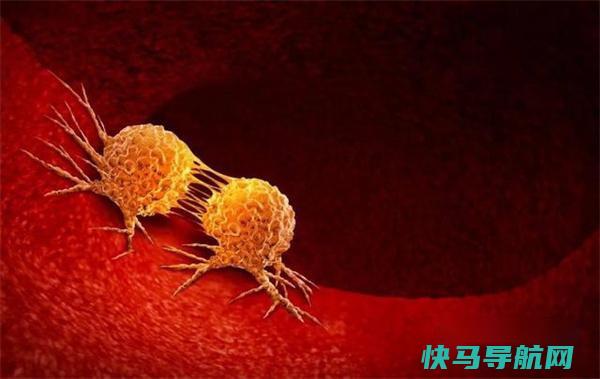 癌细胞已扩散 为何病人依旧显得精神奕奕 胃口良好 告诉你真相